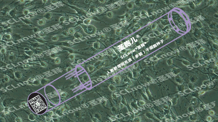 SCLnow<sup>®</sup>圣释<sup>®</sup>与湘雅医院首个标准化的干细胞临床研究： 安心存圣胞儿<sup>®</sup>! 放心用释胞儿<sup>®</sup>！