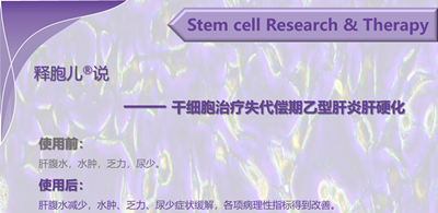 释胞儿<sup>®</sup>说——干细胞治疗失代偿期乙型肝炎肝硬化